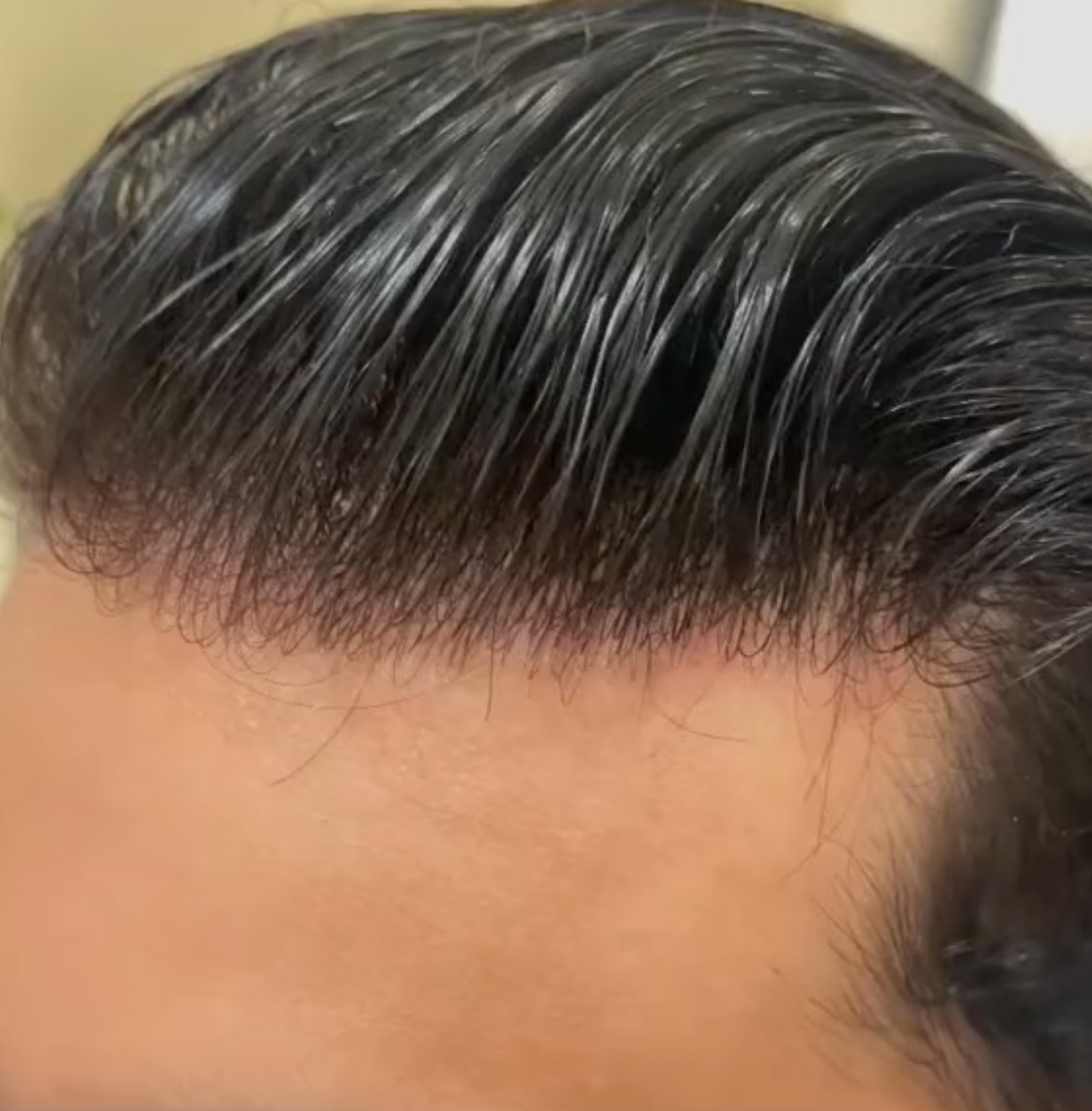 Our top tip to help you conceal your hairline with your new hair system